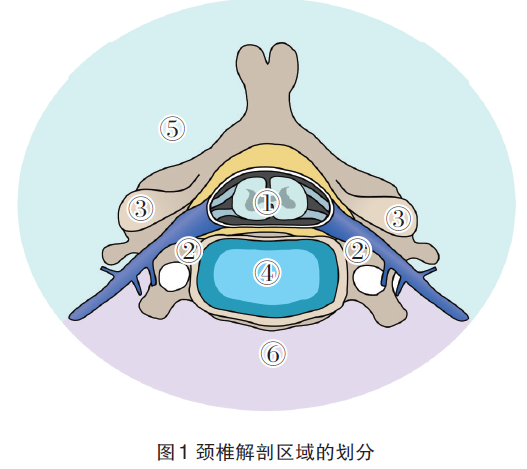 颈椎管内外哑铃形肿瘤的外科治疗策略_颈椎管