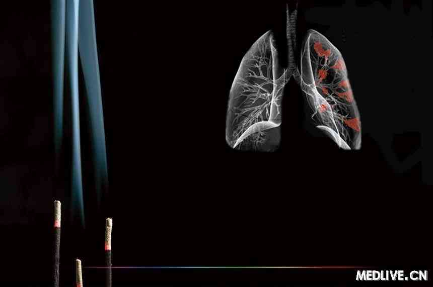 吸烟兼烧香者患肺癌机率高4倍_肺癌_吸烟_烧