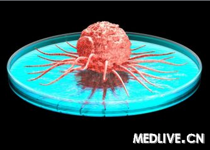 防癌新机制:用DCC基因诱导癌细胞凋亡_防癌