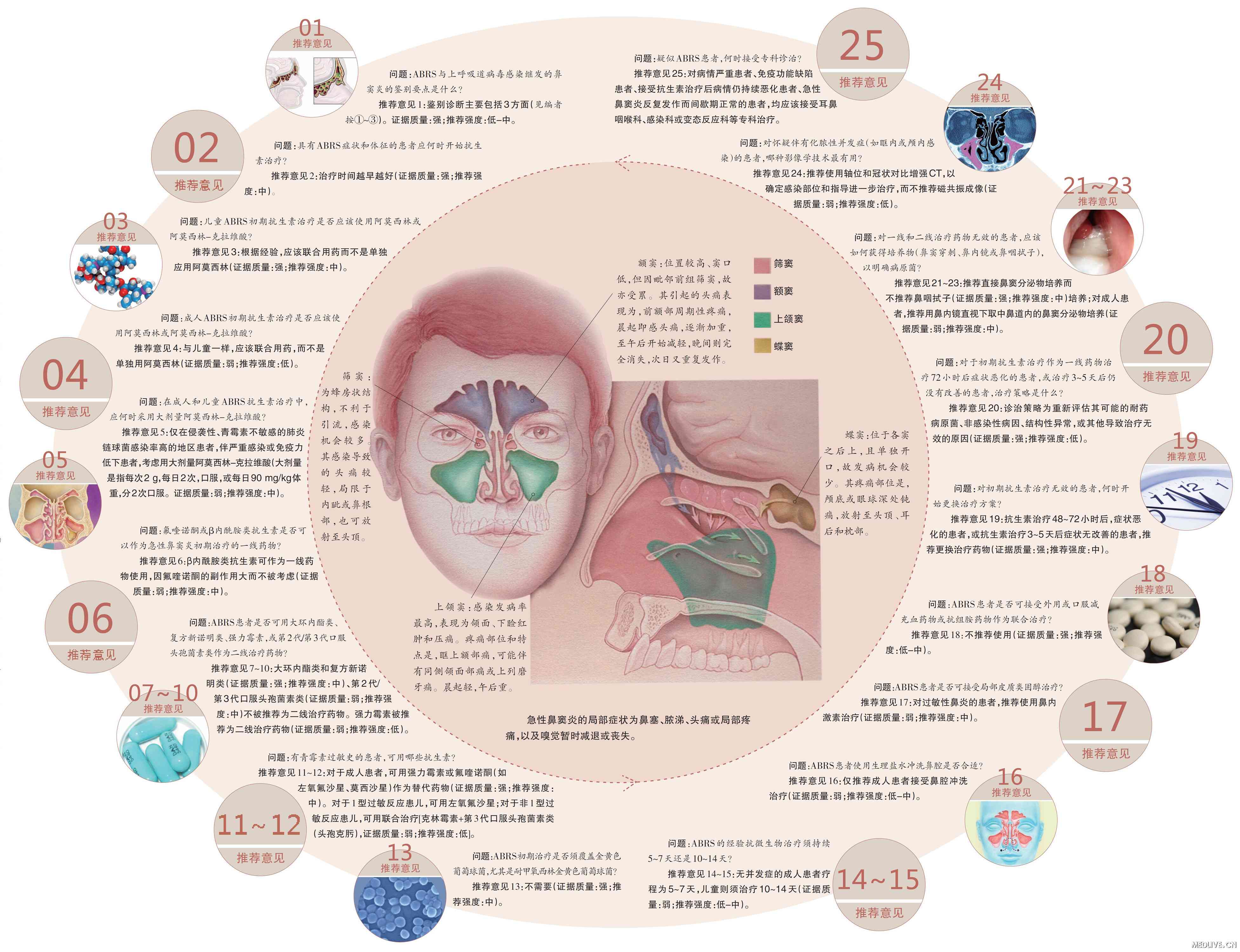 指南解析：儿童和成人急性细菌性鼻窦炎_急性细菌性鼻窦炎_指南