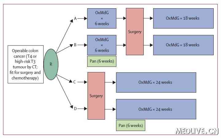 Lancet:结肠癌术前化疗可行_结肠癌_术前化疗