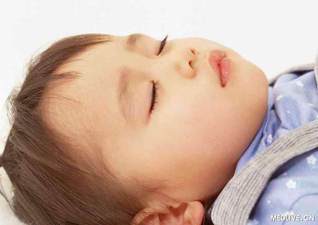 睡眠呼吸暂停 SDB  行为睡眠问题