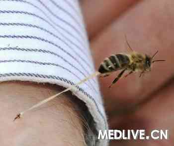 蜂刺毒素可杀死艾滋病毒(转自:人民网)