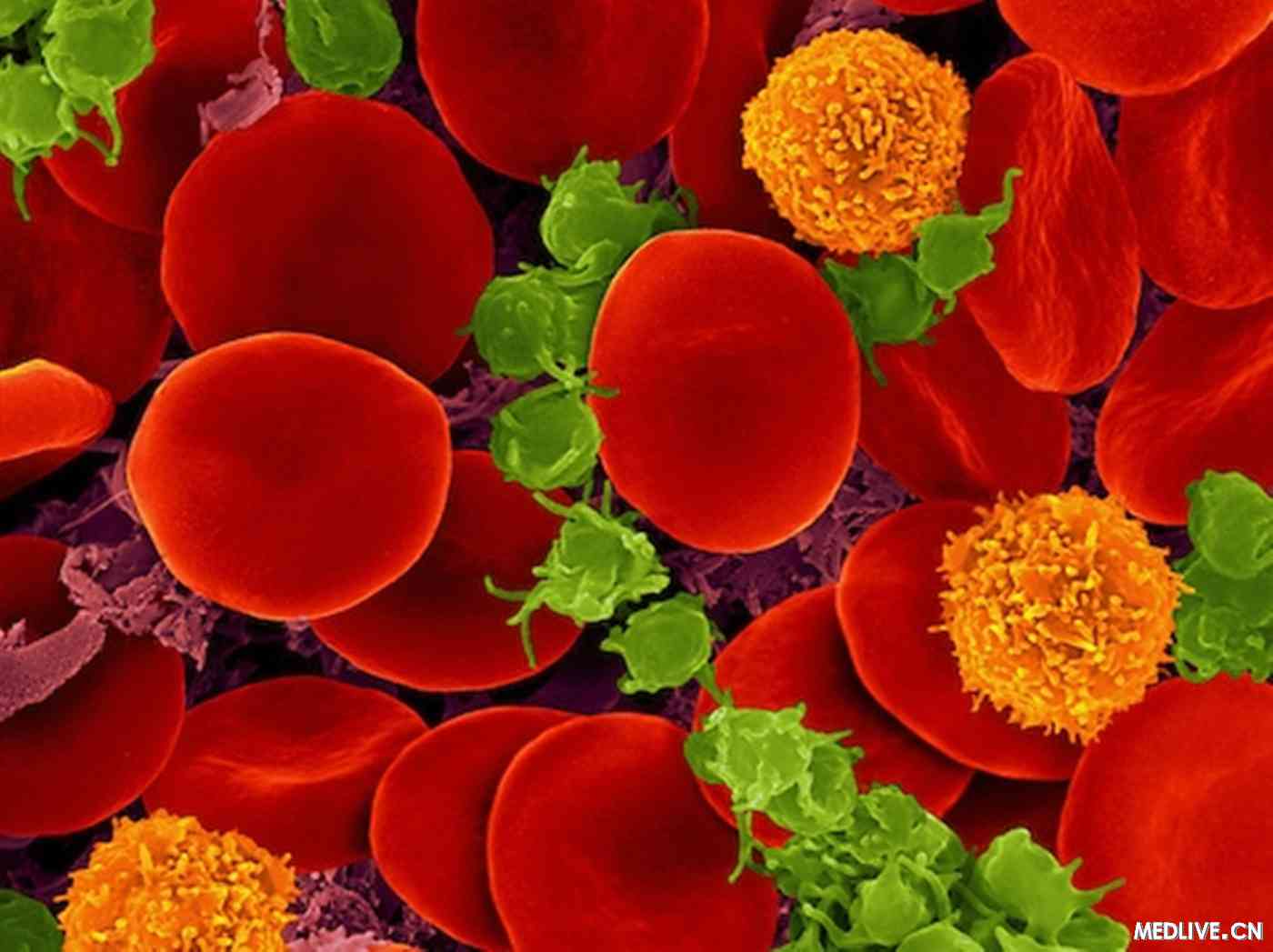 NEJM评论:血液肿瘤患者需要预防性输注血小板