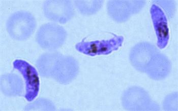 cd4 cd25 调节性t细胞对疟原虫感染鼠结局的影响