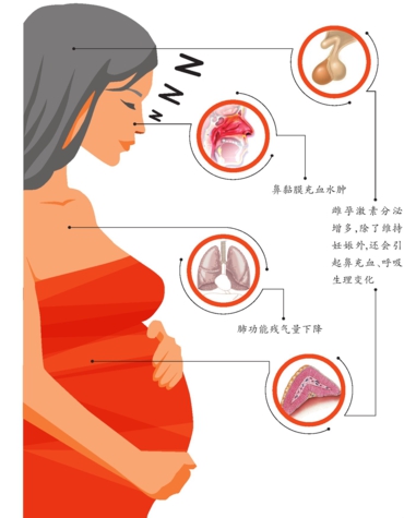 妊娠合并睡眠呼吸紊乱的危害、机制及诊治_睡