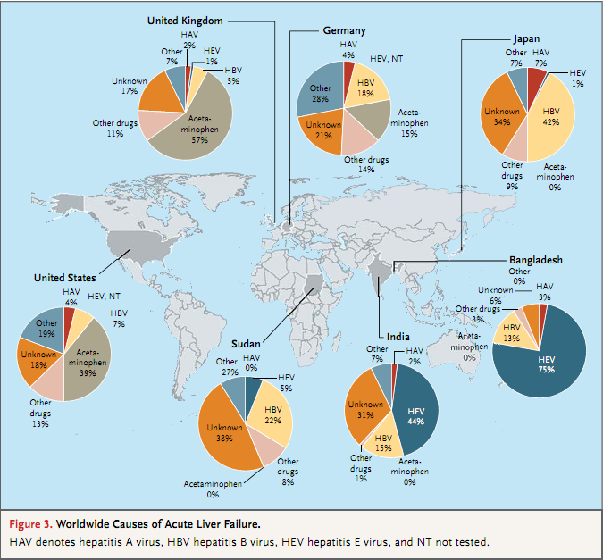NEJM综述:急性肝功能衰竭.png