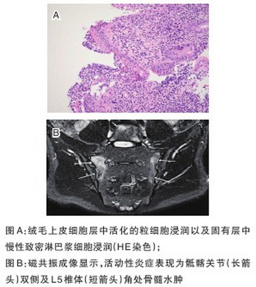 人口学特征包括哪些_压疮患者的人口学特征和临床特征调查分析(2)