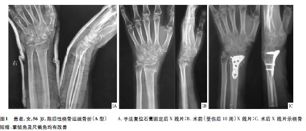 锁定解剖钢板内固定治疗陈旧性桡骨远端骨折_