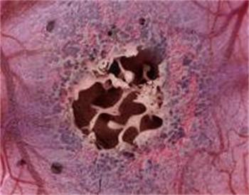 Nature子刊：可体外复制造血微环境的骨髓芯片