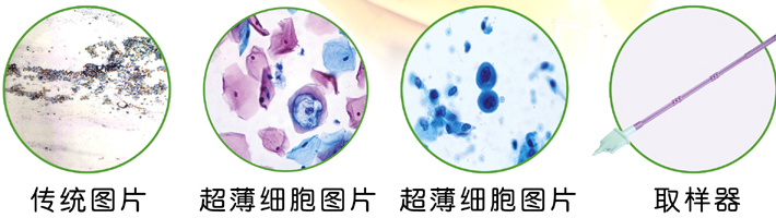 巴氏涂片检查 VS HPV检测