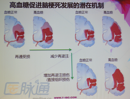 [TISC2014]徐安定:卒中患者的血糖管理策略_卒中_血糖_徐安定_TISC2014_医脉通