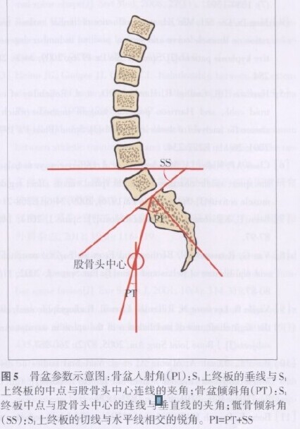 腰椎前凸的相关研究进展_腰椎前凸_影响因素_医脉通