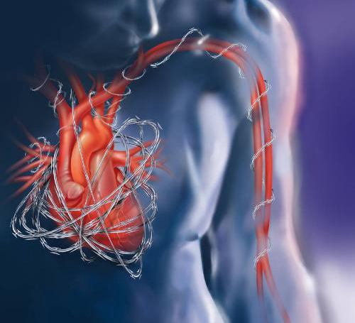 云南一院近日成功实施1例高难度心脏手术_心