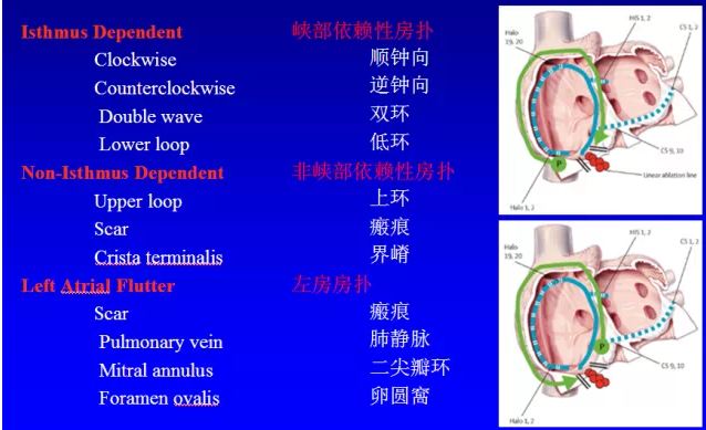 方丕华:图解老年人心律失常特点_心律失常_老