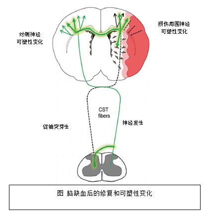 五羟色胺再摄取抑制剂(ssri)抗抑郁治疗在卒中