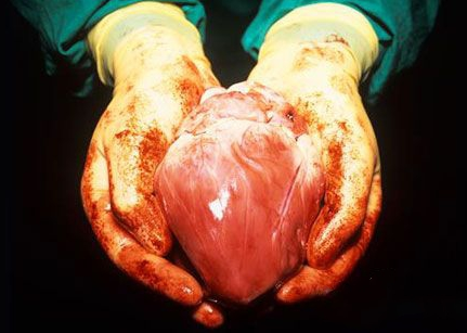 转基因猪心脏或能植入人体_心脏移植_转基因