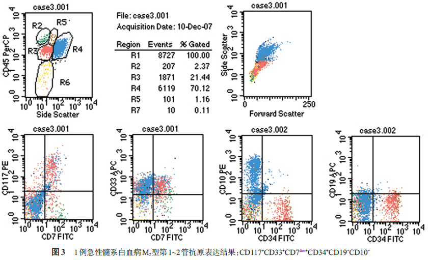 四色流式细胞术用于急性白血病免疫分型的中国