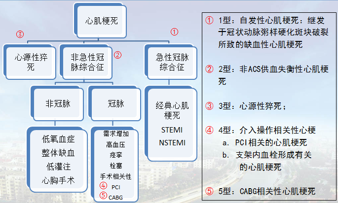 张振刚教授:急性心肌梗死诊断标准的变迁_急性