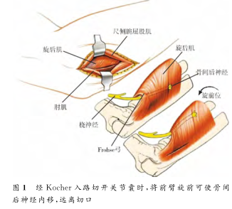 肘关节手术入路