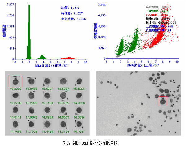 宫颈细胞DNA倍体分析检测宫颈病变的临床价