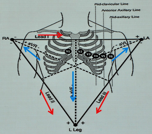 前言:avr导联的价值 心电图图形及电压的影响因素包括:(1)电极位置