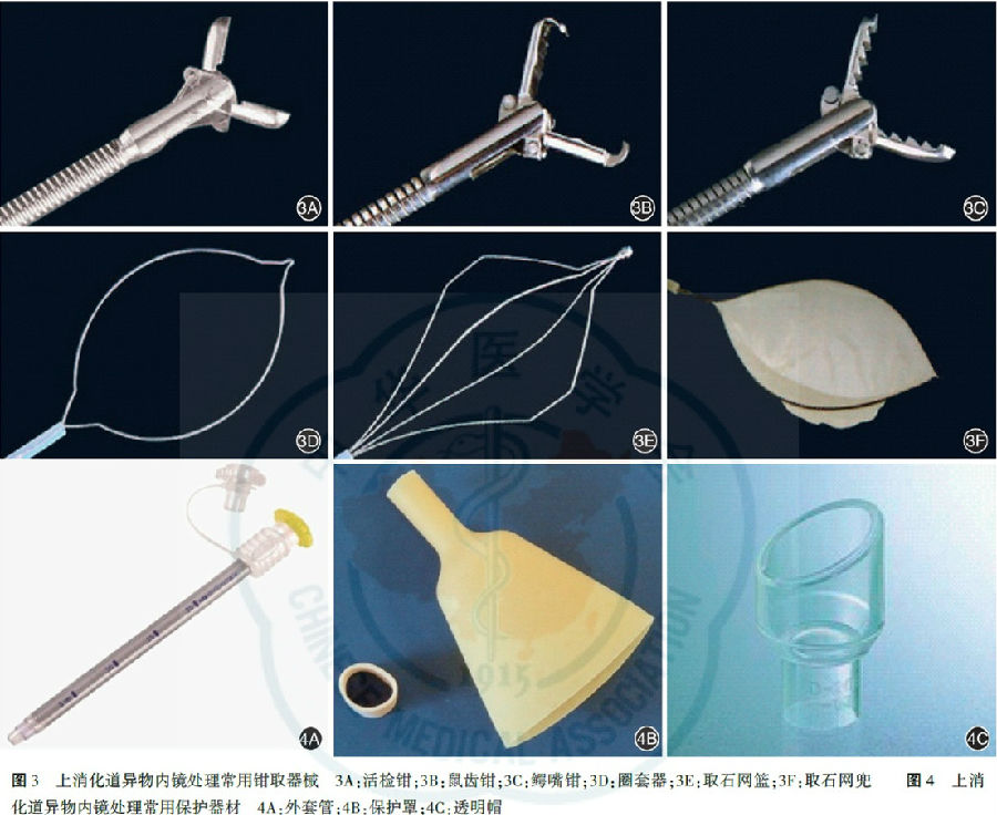 2015年中国上消化道异物内镜处理专家共识意见