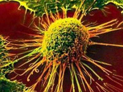 验血能为皮肤癌的复发提供早期预警_血液检验