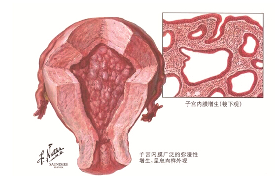 妇科癌症筛查的秘密