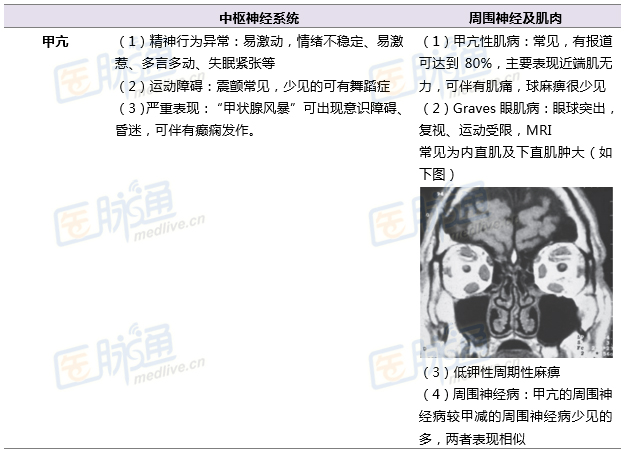 细数与内分泌异常密不可分的神内疾病_内分泌