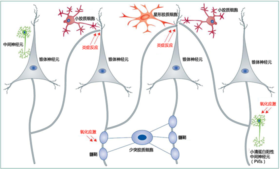 柳叶刀综述:精神分裂症(下)_柳叶刀_精神分裂症_病理_医脉通