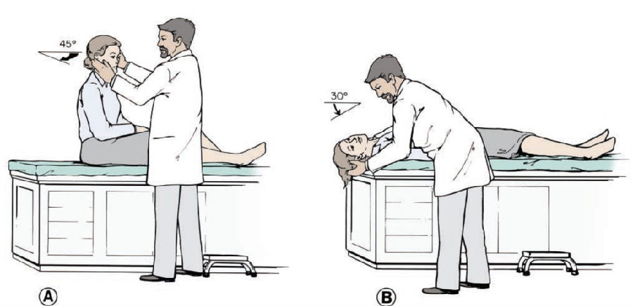 bppv_bppv诊断标准