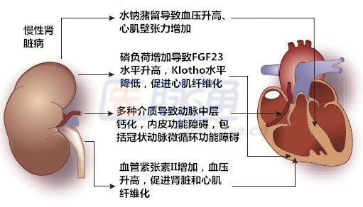 慢性肾脏病动脉粥样硬化性心血管疾病的治疗