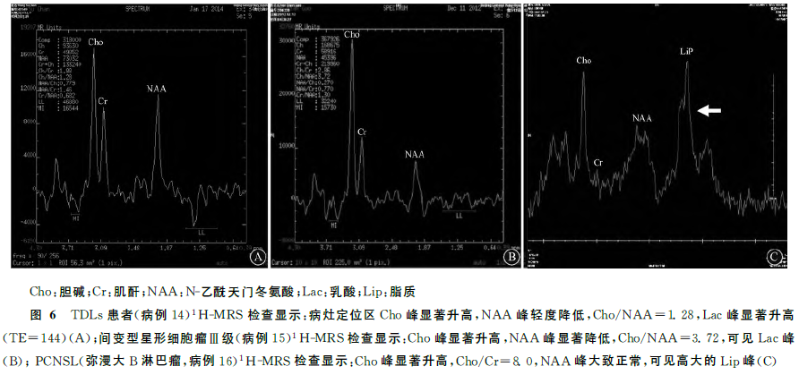 最新中枢神经系统瘤样脱髓鞘病变诊疗指南发布