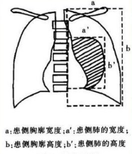 气胸30自愈多久