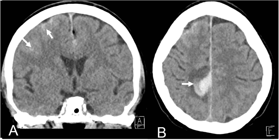 视力正常轴位多少,视力正常标准是多少