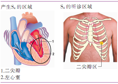 心音听诊