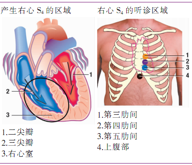 磨耳朵」系列之第三、第四心音全解|临床基本功_心音听诊_第三心音_第四 