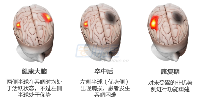 炒股票怎么玩领跌板块