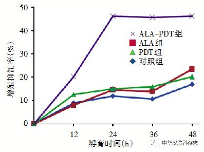 pdt时间