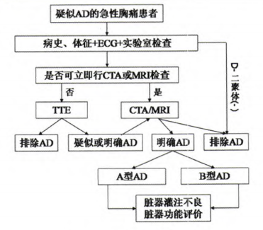 主动脉夹层的诊断流程