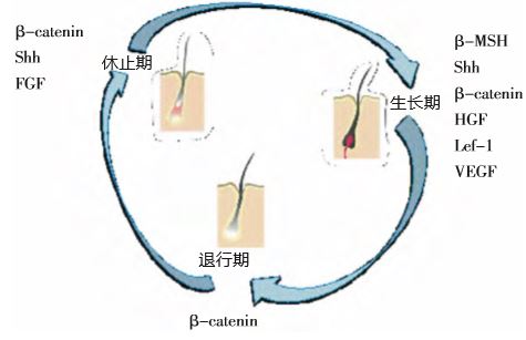 中草药治疗雄激素性秃发的实验研究进展