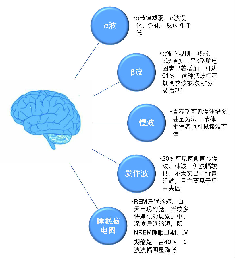 被忽略的神兵利器--脑电图在精神科的应用价值