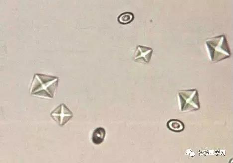 尿酸结晶(uric acid crystal)