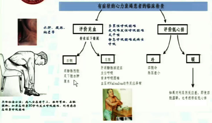 丁文惠教授:心衰治疗中的容量管理流程,你都g