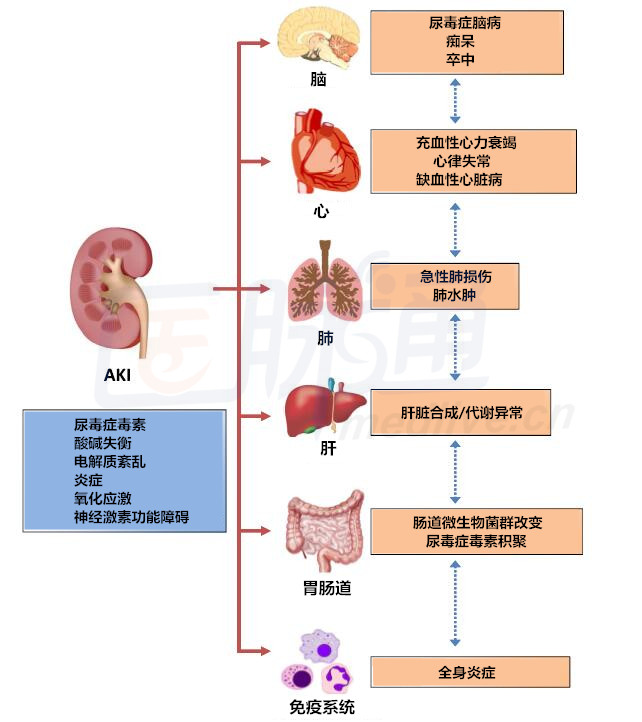 肾损伤只伤肾?no,小心你的心,肝,脑,肺,肠!