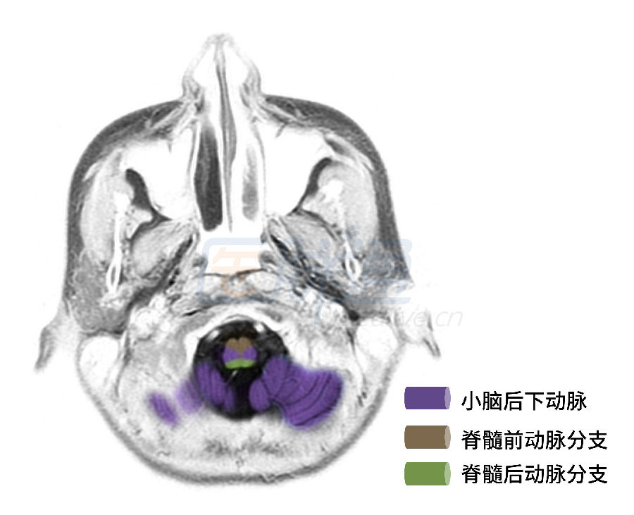 神经科医生必备脑动脉供血区图谱收藏