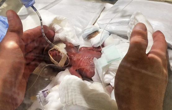 华西医院有偿招募脱发志愿者,18岁-60岁均可 