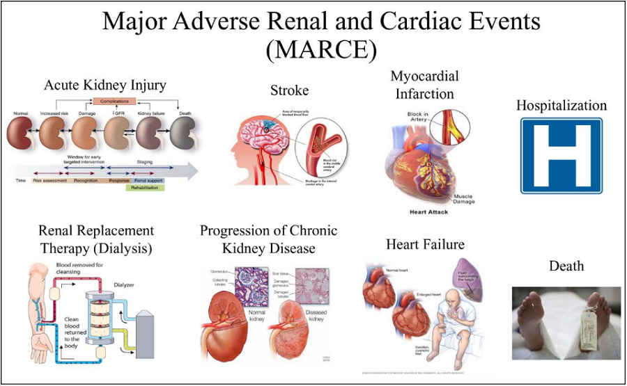 2019 AHA心肾综合征科学声明发布:十大要点一览