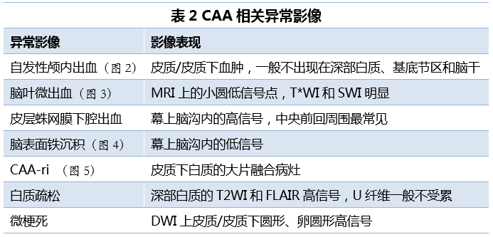 caa是什么意思,caa是什么意思的缩写